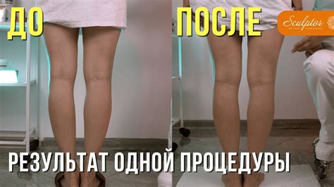 Непропорциональный размер: вызовы женщин с большими ногами